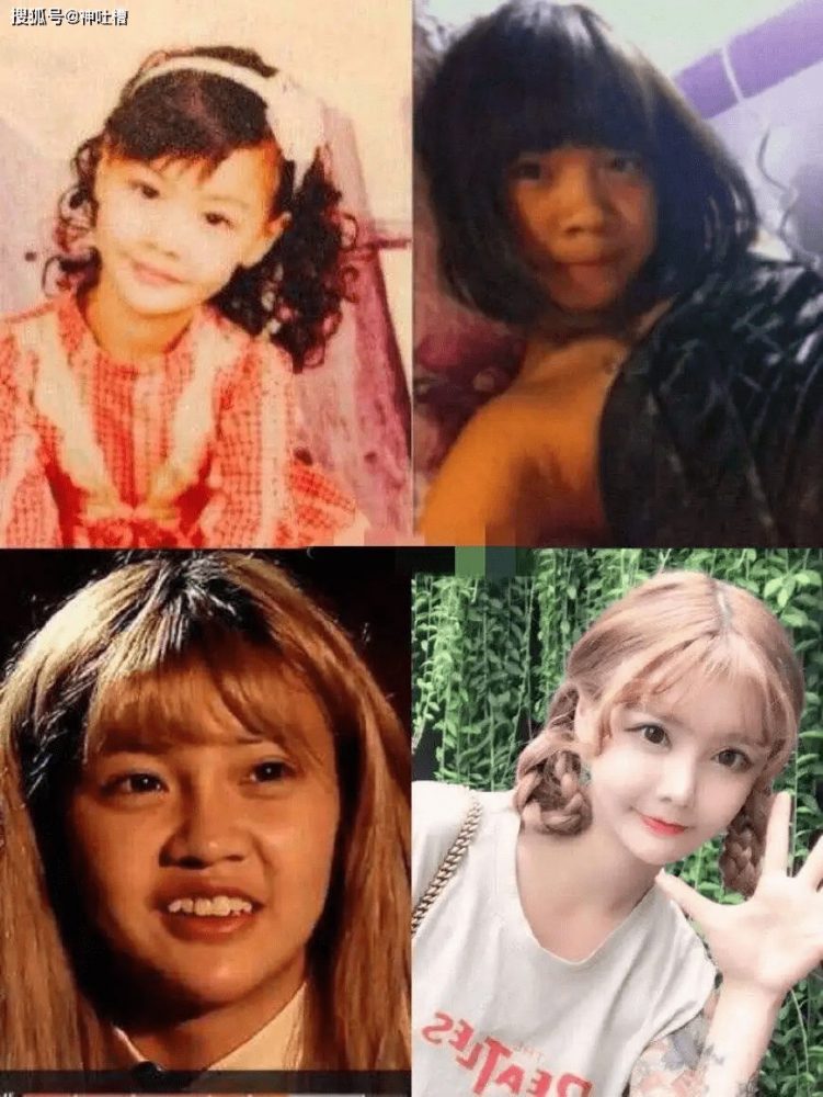 9869b27944c44a02887291a9a95a6025-1664206141-78 Chi 50 tỷ để phẫu thuật thẩm mỹ vì không hài lòng với toàn bộ cơ thể 9869b27944c44a02887291a9a95a6025 1664206141 78