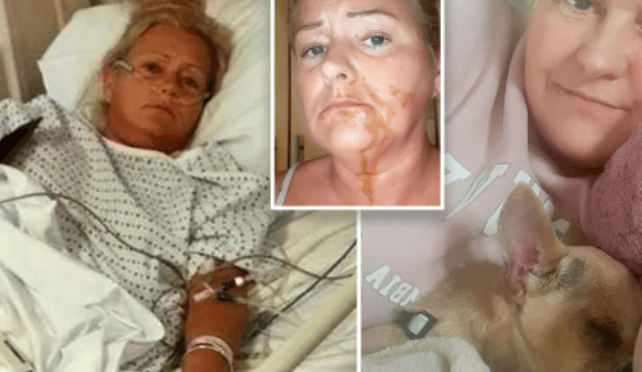 Bị cún cưng phóng uế vào miệng khi đang ngủ, người phụ nữ 51 tuổi phải nhập viện cấp cứu 26 Bị cún cưng phóng uế vào miệng khi đang ngủ, người phụ nữ 51 tuổi phải nhập viện cấp cứu cun cung 1664265792 13