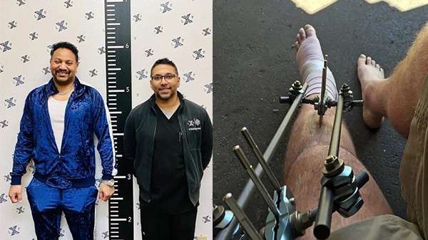 Người đàn ông 40 tuổi vay nợ gần 2 tỷ đồng để kéo dài chân thêm 8cm untitled 1 1663727360 63