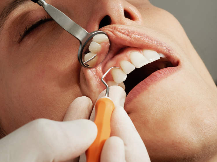 Tự nhổ răng trong hơn 10 năm vì không hẹn nổi nha sĩ dentistry 1666159048 88