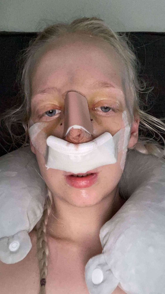 Người mẫu OnlyFans chi 11.000 USD để phẫu thuật cho giống búp bê người lớn của bạn trai sex doll 54 1666604062 50