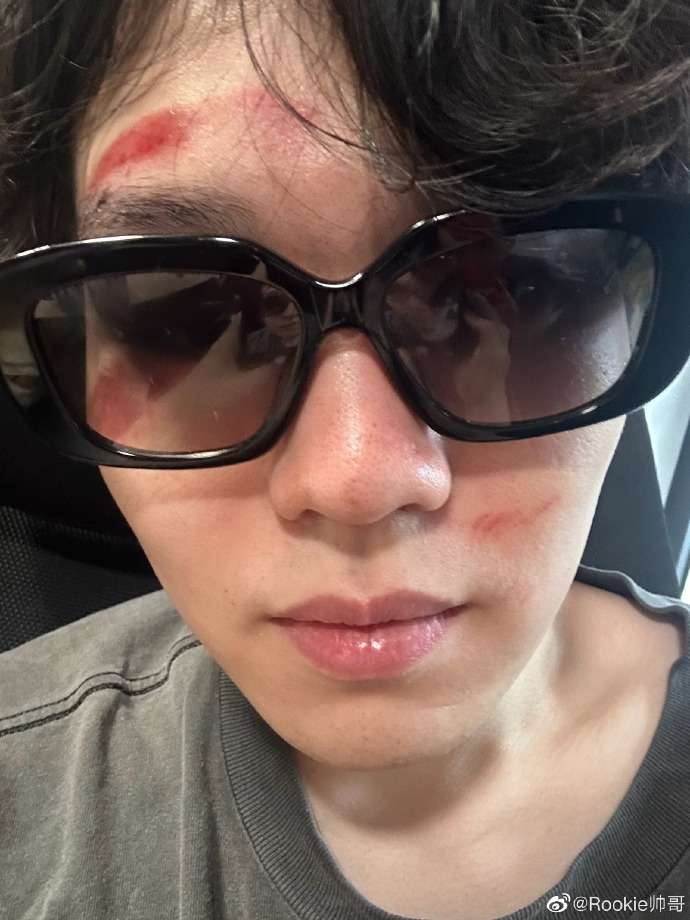 Rookie tố đồng đội đấm mình trước thềm LPL Mùa Hè 2023 tes rookie 1684412111 1