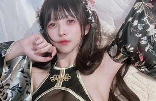 Nữ streamer đăng ảnh chụp X quang kèm chẩn đoán của bác sĩ để chứng minh "mọi thứ đều là thật", nói nếu sai thì sẽ "mất sạch, mất trắng" avatar1732009467039 17320094673161695192128png