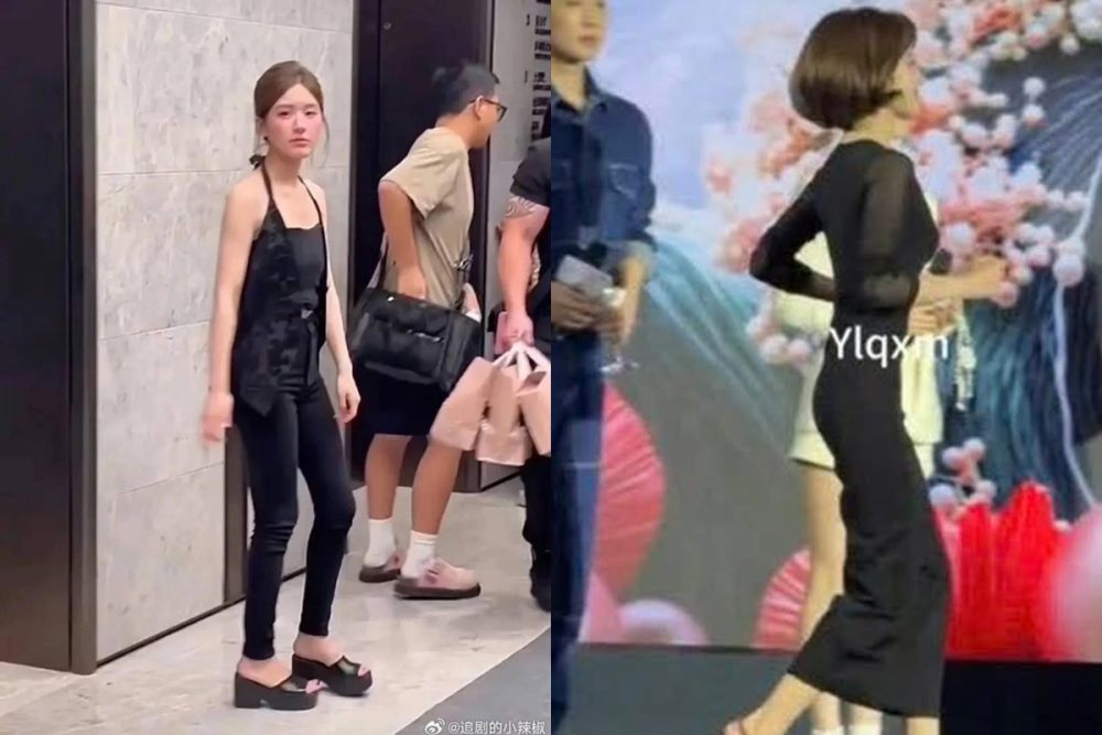 Bức ảnh tiên tri bệnh tật nghiệt ngã của Triệu Lộ Tư cách đây 5 năm khiến hàng triệu người rùng mình- Ảnh 5. Bức ảnh tiên tri bệnh tật nghiệt ngã của Triệu Lộ Tư cách đây 5 năm khiến hàng triệu người rùng mình- Ảnh 5.