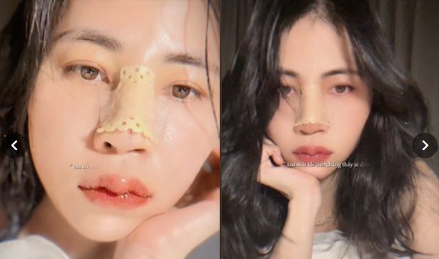 Dân tình đặt câu hỏi nhạy cảm về việc Thơ Nguyễn "dao kéo", nữ YouTuber nói gì? - Ảnh 2. Dân tình đặt câu hỏi nhạy cảm về việc Thơ Nguyễn "dao kéo", nữ YouTuber nói gì? - Ảnh 2.