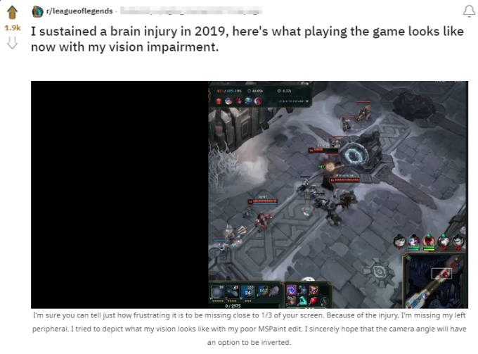 Gần như mất cả thị lực, game thủ Liên minh không từ bỏ, làm quen luôn với việc chơi game trong "bóng tối" - Ảnh 2. Gần như mất cả thị lực, game thủ Liên minh không từ bỏ, làm quen luôn với việc chơi game trong "bóng tối" - Ảnh 2.