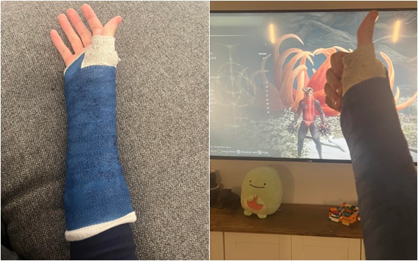 Bá đạo như nam game thủ, gãy một tay vẫn làm thử thách hạ gục boss ngay từ level 1 và cái kết bất ngờ - Ảnh 2. Bá đạo như nam game thủ, gãy một tay vẫn làm thử thách hạ gục boss ngay từ level 1 và cái kết bất ngờ - Ảnh 2.