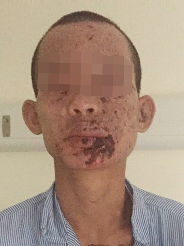 Cảnh báo! Giữ thói quen chơi điện thoại nguy hiểm, một game thủ Việt trả giá đắt bằng chính đôi mắt mình - Ảnh 2.