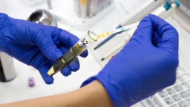 Cãi nhau xong phá hỏng túi hàng hiệu của người yêu, anh chàng Hàn Quốc chịu hậu quả nặng nề - Ảnh 2. Cãi nhau xong phá hỏng túi hàng hiệu của người yêu, anh chàng Hàn Quốc chịu hậu quả nặng nề - Ảnh 2.