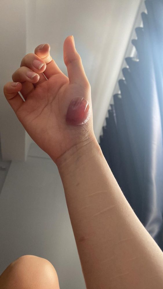 photo-1-1681134494815205367814-1681175129819-1681175130176981707406 Hot girl người Tày Ceri Thu Hà lần đầu nói về các vết thương chằng chịt trên cánh tay photo 1 1681134494815205367814 1681175129819 1681175130176981707406