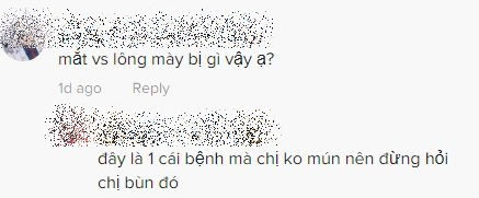 photo-1710905071190 photo-1710905071190