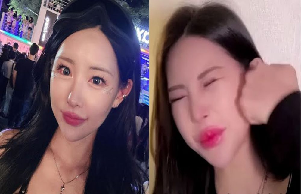 Từng thừa nhận can thiệp thẩm mỹ, nữ YouTuber vẫn tự tay "tác động vật lý" cực mạnh vào "mặt tiền" vì một điều - Ảnh 3. Từng thừa nhận can thiệp thẩm mỹ, nữ YouTuber vẫn tự tay "tác động vật lý" cực mạnh vào "mặt tiền" vì một điều - Ảnh 3.