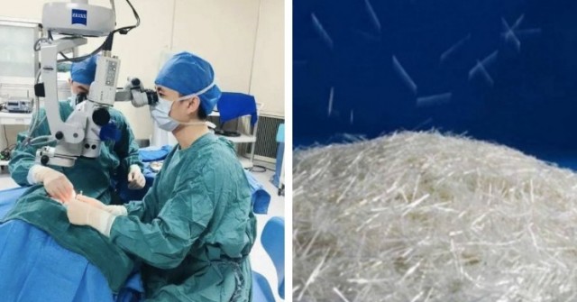 TQ: Người đàn ông bị mảnh thủy tinh đâm vào mắt khi mở kiện hàng 0 1 1741570704 389 width740height495 auto cropjpg 1