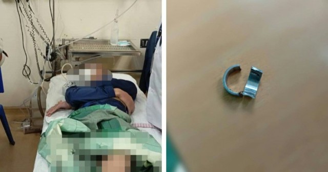 0-1739075044-522-width740height495-auto-cropjpg-1 Nghịch dại đeo nhẫn vào “của quý”, chàng trai phải nhờ trợ giúp của bác sỹ và lính cứu hỏa 0 1739075044 522 width740height495 auto cropjpg 1