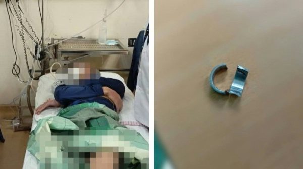 Nghịch dại đeo nhẫn vào “của quý”, chàng trai phải nhờ trợ giúp của bác sỹ và lính cứu hỏa 27 Nghịch dại đeo nhẫn vào “của quý”, chàng trai phải nhờ trợ giúp của bác sỹ và lính cứu hỏa 0 1739075044 522 width740height495 auto cropjpg