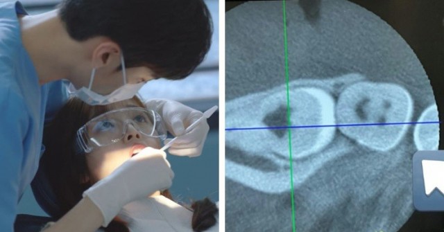 Ảnh chụp X-quang răng khôn khiến cư dân mạng cười nghiêng ngả 0 1741568570 91 width740height495 auto cropjpg 1