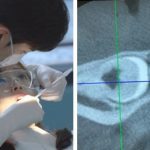 Ảnh chụp X-quang răng khôn khiến cư dân mạng cười nghiêng ngả 0 1741568570 91 width740height495 auto cropjpg