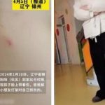 TQ: Cô giáo mầm non làm xước mặt bé 6 tuổi, phải bồi thường 140 triệu 0 1744258735 648 width740height495 auto cropjpg