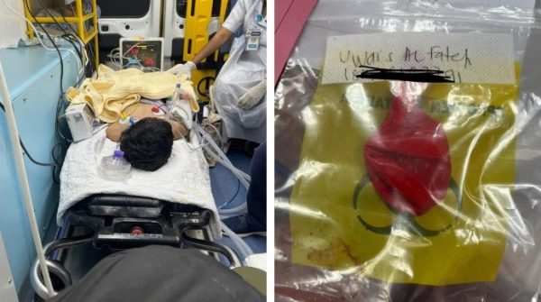 Bé trai bị ngưng tim ngay giữa buổi tiệc sinh nhật vì quả bóng bay 0 1748400052 321 width740height495 auto cropjpg