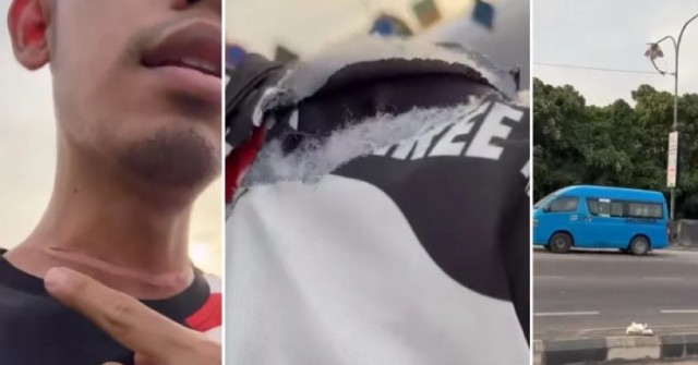 Bị dây diều sắc như dao cứa vào cổ khi đang đi xe máy, nạn nhân bàng hoàng lên tiếng 0 1753368841 452 width740height495 auto cropjpg 1