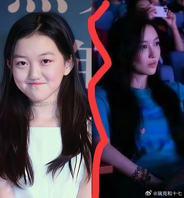 Không nhận ra con gái 19 tuổi của Vương Phi sau 4 lần phẫu thuật hở hàm ếch- Ảnh 5.