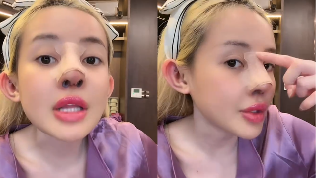 Ngân 98 bị biến chứng nhiễm trùng nặng sau 11 lần phẫu thuật thẩm mỹ- Ảnh 8.