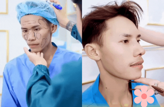 Chàng trai hot nhất Nam vương Campuchia đạt kết quả không tưởng sau 2 tháng sửa hết mặt tại Việt Nam- Ảnh 4.