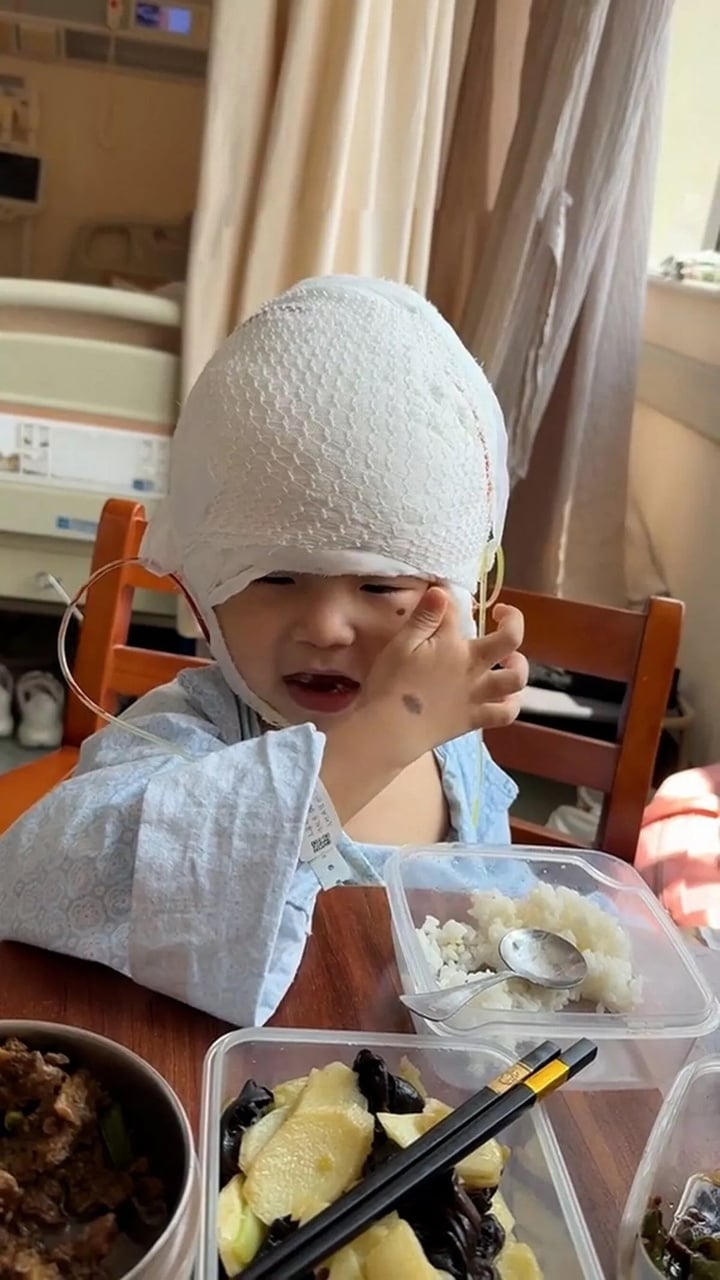 Nốt ruồi khổng lồ phủ kín hộp sọ khiến cậu bé có ngoại hình giống chuột Mickey- Ảnh 4.