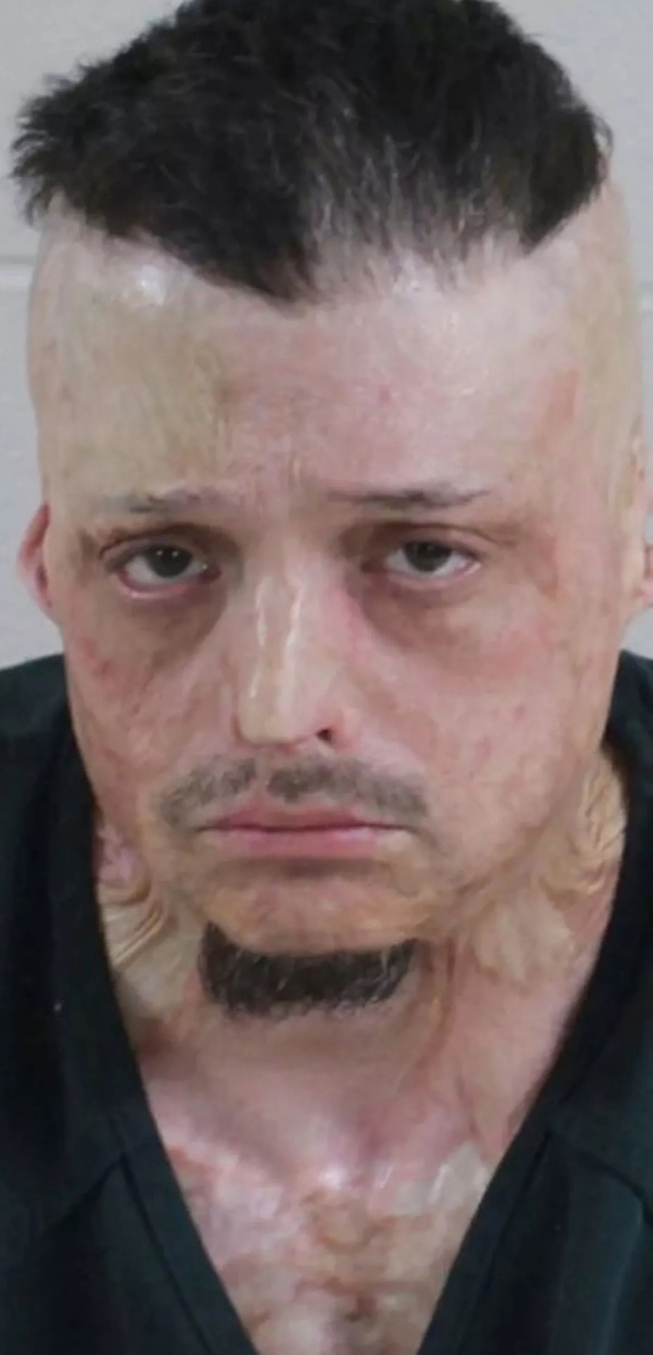 Người mẹ tàn độc trói tay con trai 6 tuổi để mặc chó pitbull cắn xé lĩnh án tù- Ảnh 3.