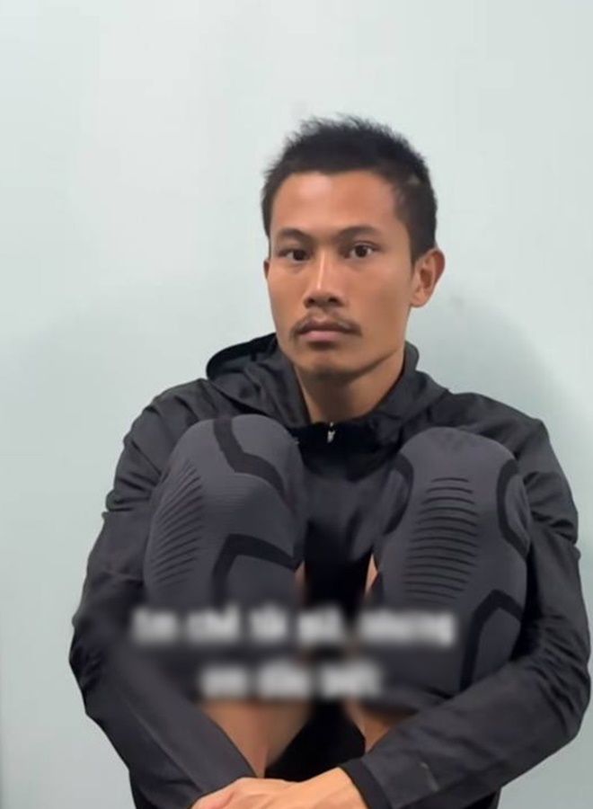 Màn huỷ dung sốc nhất Mưa Đỏ: Ngoài đời là cực phẩm nam thần, lên phim đầu chi chít sẹo nhìn mà choáng- Ảnh 2.