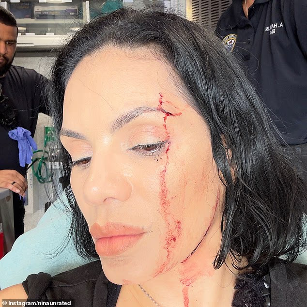 Đang quay mukbang trong nhà hàng sang trọng, cặp đôi nổi tiếng bất ngờ bị một chiếc SUV lao xuyên cửa đâm trúng- Ảnh 1.