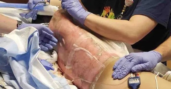 5 thử thách TikTok cực nguy hiểm, có một thử thách từng giết chết hơn 100 người 12 year old boy turns 114972934 11092431 1763096173707 17630961739241007624453 0 42 405 690 crop 1763096242313540133761jpeg