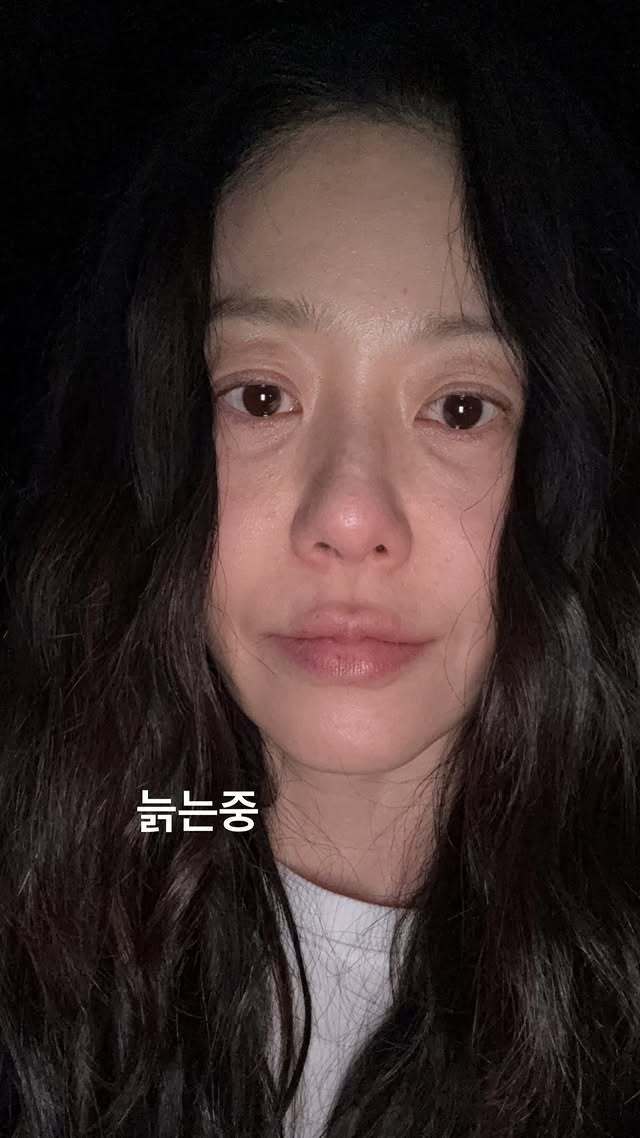 "Á hậu từng bị đế chế Samsung ruồng bỏ" lộ mặt mộc sau phẫu thuật, gây xôn xao với lời thừa nhận về tuổi tác 1309186021 1737597732129 1737597736446364956460 1737598454766 17375984552731892503265 1737605101596 17376051016891199574409 1737610534369 17376105351701556431887