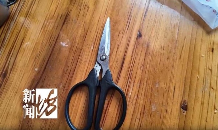 Cụ bà 98 tuổi dùng kéo cắt 'sừng trường thọ' trên trán, dẫn đến nguy kịch- Ảnh 2.