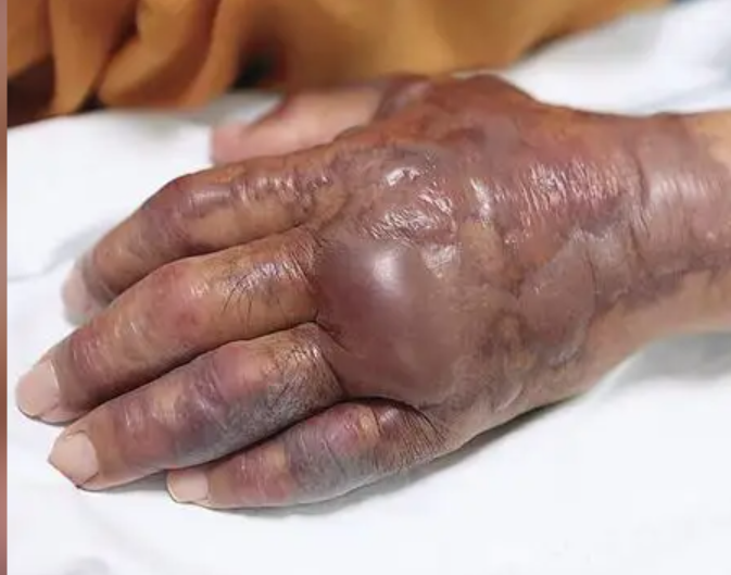 Hàn Quốc khuyến cáo tránh ăn hải sản sống vì