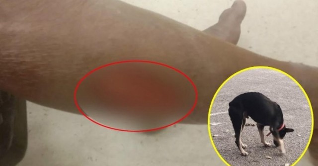 Kinh hoàng chó nhà tấn công 6 người đi đường, chủ chó "vô can" vì lý do bất ngờ 1742704620 806 thumbnail width740height495 anh cat 3 2 auto cropjpg 1