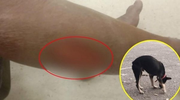 Kinh hoàng chó nhà tấn công 6 người đi đường, chủ chó "vô can" vì lý do bất ngờ 1742704620 806 thumbnail width740height495 anh cat 3 2 auto cropjpg