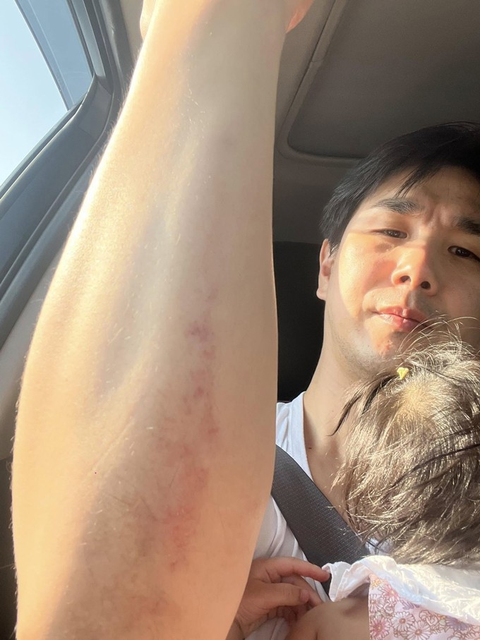 Kwon ôm con với cánh tay trầy xước sau động đất. Ảnh: FB