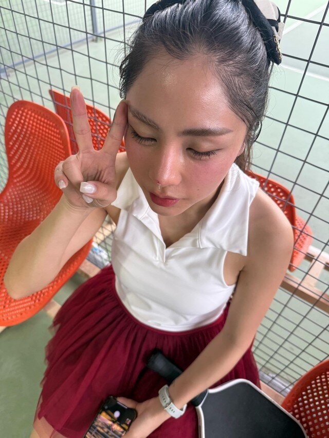 Sao Việt ngồi xe lăn, xước mặt bởi cùng một lý do: Vợ Mạc Hồng Quân phải phẫu thuật, Bảo Thanh