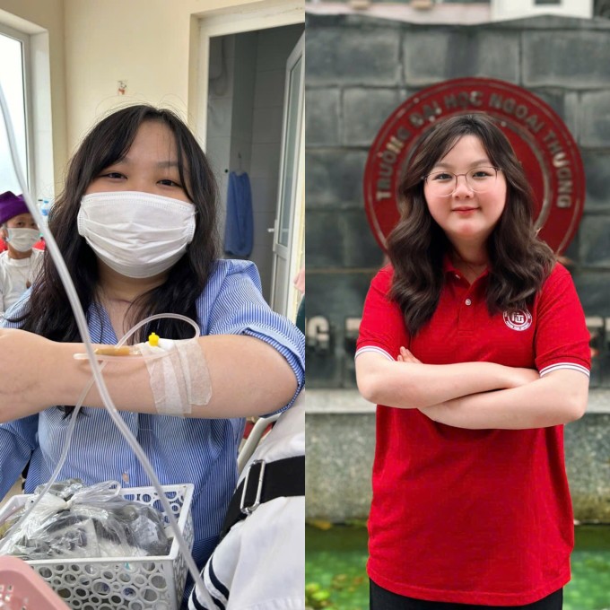 Hà Châu, 20 tuổi, quê Hòa Bình mắc ung thư tuyến yên, năm 2025. Ảnh: Nhân vật cung cấp
