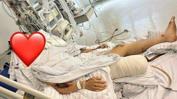 TikToker “Bốp Bọt Biển” bị tai nạn tại Đức: Chấn thương nặng, mất một chân 1753256419 r 2 72020 0647 5 86092 width1300height975