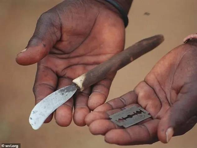 Các thầy cắt sử dụng dụng cụ không được khử trùng và dùng chung nhiều người. Ảnh: Wvi