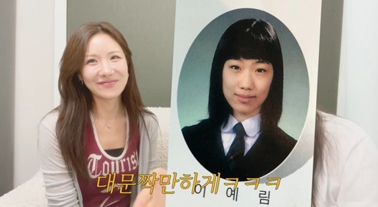 Nữ diễn viên từng thẩm mỹ hỏng: “Lao đầu” vào 8 lần cắt mắt, 3 lần nâng mũi, gọt hàm và nâng ngực- Ảnh 1.