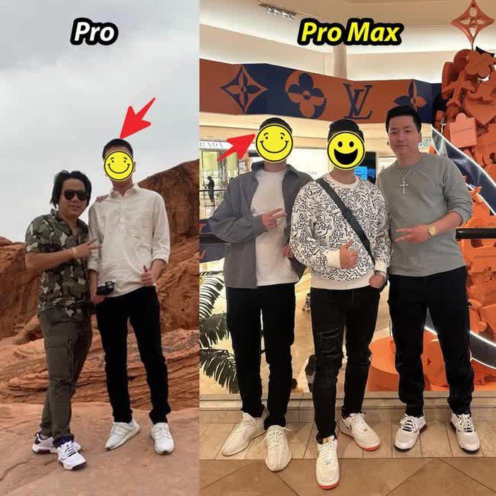 YouTuber Khoa Pug đã chi 3 tỉ để nâng chiều cao