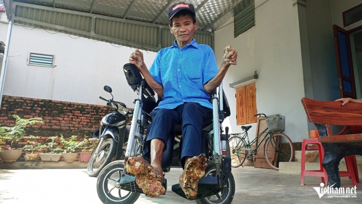 1761006134-w-nguoi-cay-3-2446-width1920height1081 Cuộc sống hiện tại của ông Sơn chỉ gắn liền với chiếc xe lăn để di chuyển