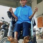 Cuộc sống của người đàn ông mắc bệnh 'người cây' hiếm gặp ở Ninh Bình 1761006476 662 thumbnail width740height495 anh cat 3 2 auto cropjpg