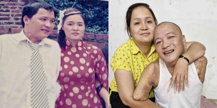 1762303320-anh-3-2231-width800height400 Vợ chồng anh không ngừng nỗ lực để cho các con cuộc sống đủ đầy