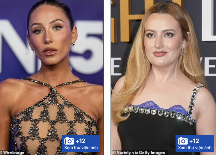 Chuyên gia lý giải vì sao gen Z nhanh già hơn thế hệ trước- Ảnh 3. Chuyên gia lý giải vì sao gen Z nhanh già hơn thế hệ trước- Ảnh 3.