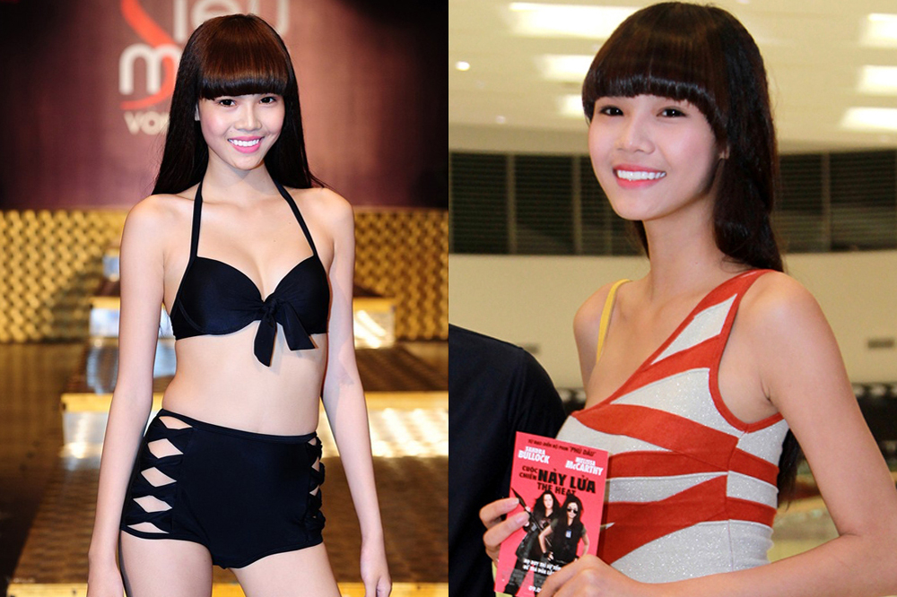 Người mẫu Việt tự khui ảnh thẩm mỹ mặt, thừa nhận rơi khủng hoảng vì sợ biến dạng vĩnh viễn- Ảnh 1. Người mẫu Việt tự khui ảnh thẩm mỹ mặt, thừa nhận rơi khủng hoảng vì sợ biến dạng vĩnh viễn- Ảnh 1.