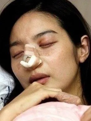Lee Min Young bị chồng đánh tới mức nhập viện, sảy thai chỉ sau 12 ngày kết hôn.